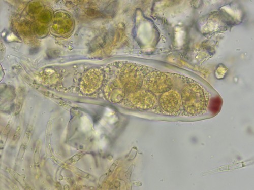 Pezicula ocellata - Asci - Baral  - 