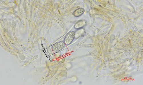 Pezicula ocellata - Spore/n - 3  - 