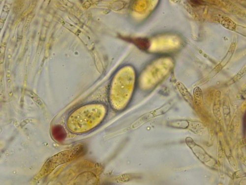 Pezicula ocellata - Asci - Baral  - 