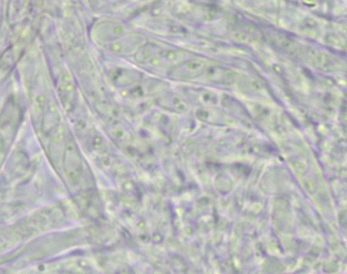 Orbilia eucalypti - 