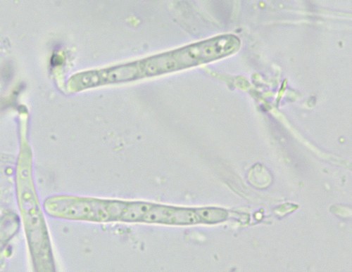 Orbilia eucalypti - 