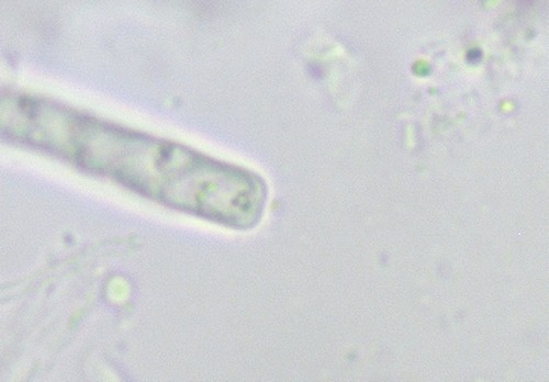 Orbilia eucalypti - 