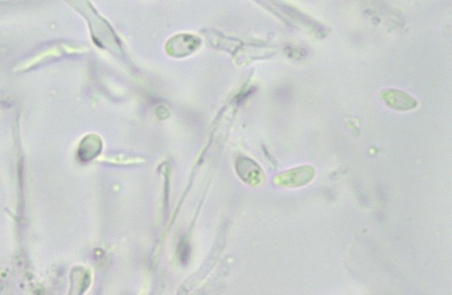 Orbilia eucalypti - 