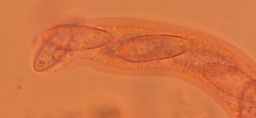 Wuestneia chrysostroma - Asci - Kongorot  - 