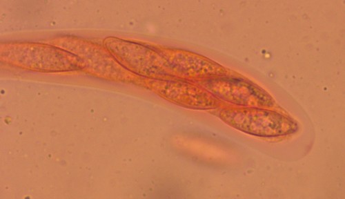 Wuestneia chrysostroma - Apikalapparat - Kongorot  - 