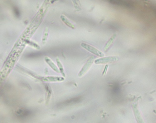 Lachnum pudicellum - Spore/n - Wasser  - 