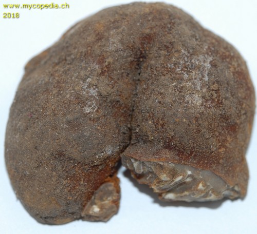 Tuber excavatum - 