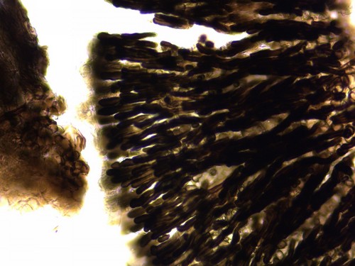 Cejpia hystrix - Randhaare - 