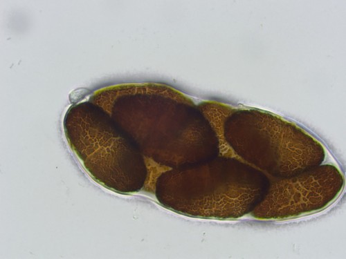 Pleospora brachyspora - 