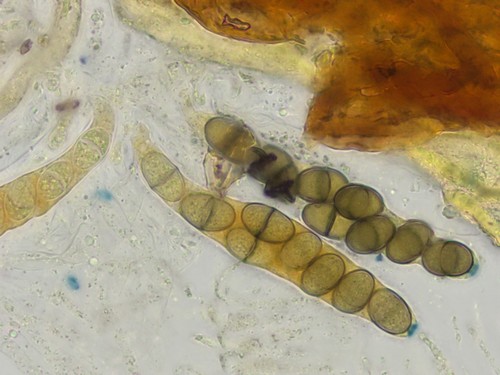 Epipolaeum absconditum - Asci - Melzers  - 