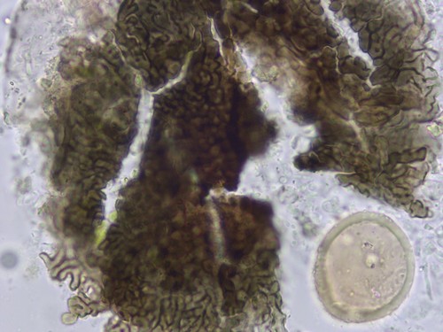 Unbestimmt auf Dryas octopetala - 