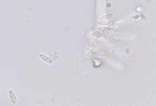 Stomiopeltis dryadis - 