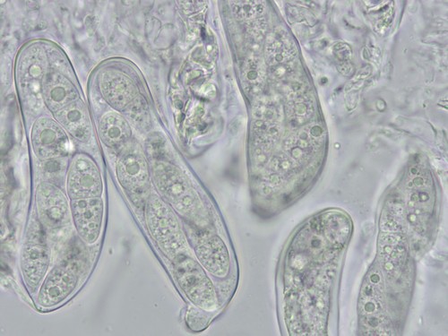Didymella macrospora - 