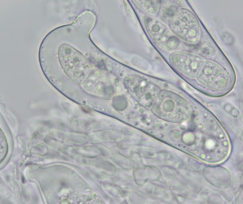 Didymella macrospora - 