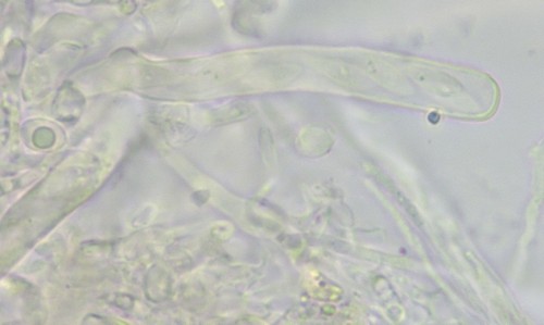 Orbilia trapeziformis - 