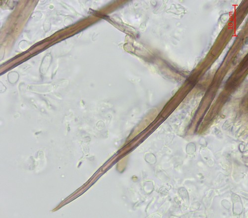 Phaeosphaeriaceae - Setae - 