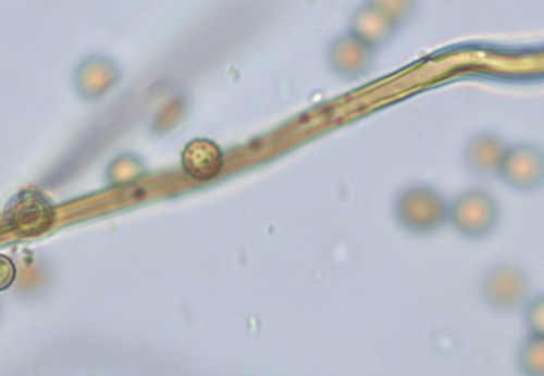 Lycoperdon norvegicum - Hyphen - 
