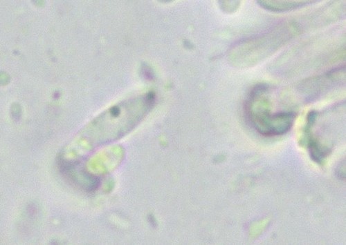 Orbilia montigena - 
