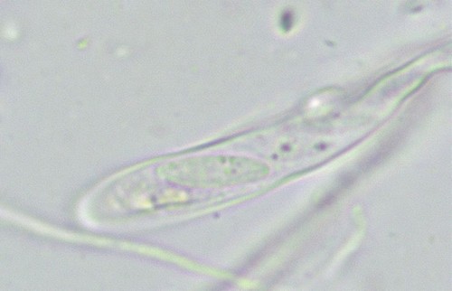 Orbilia montigena - 