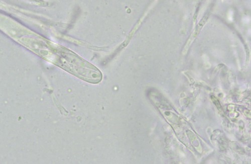Orbilia montigena - 