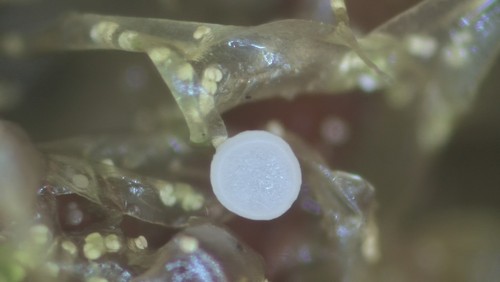 Bryoscyphus rhytidiadelphi - 