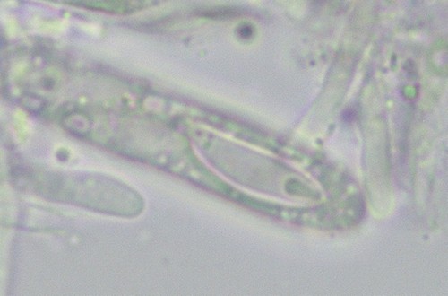 Orbilia montigena - Spore mit Sporenk�rper - Wasser  - 
