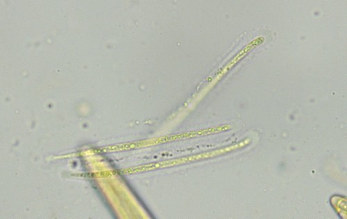 Lophodermium piceae - Spore/n mit Schleimh�lle - 