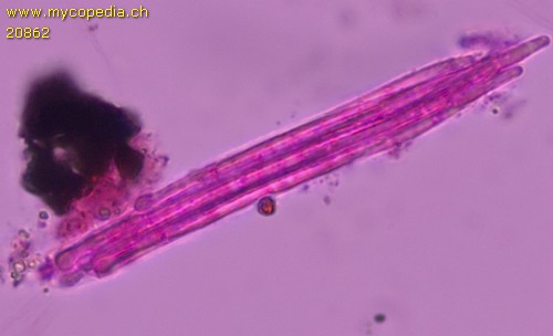 Plagiosphaera - Asci - Phloxin  - 