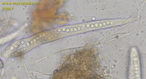 Pseudographis rufonigra - Asci - Baral