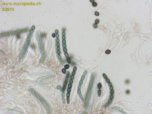 Sphinctrina leucopoda - Asci - KOH  - 