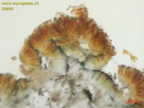 Mellitiosporium propolidoides - Quetschpr�parat �bersicht - Baral