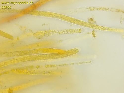 Neobarya parasitica - Asci - 
