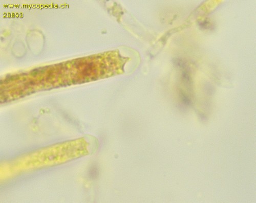 Neobarya parasitica - Apikalapparat - 