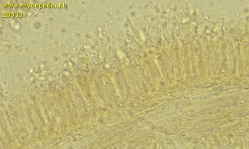 Hydropus atramentosus - Cheilozystiden - 