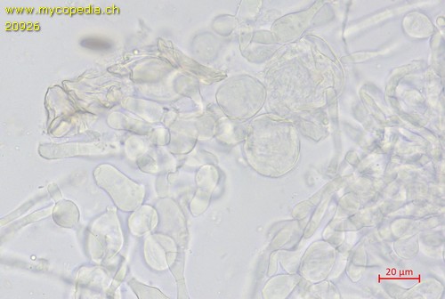 Peziza pseudogranularis - Excipulum - 