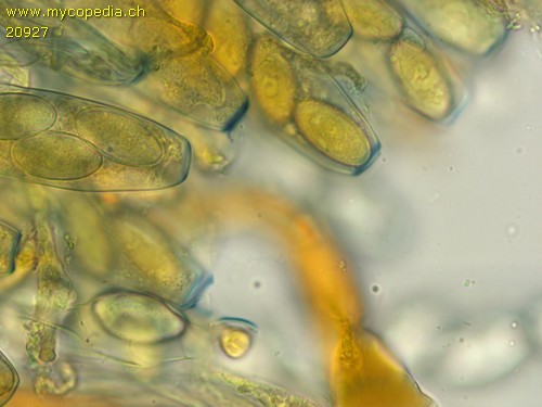Peziza pseudogranularis - Apikalapparat - Baral