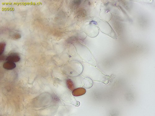 Psathyrella microrhiza - Cheilozystiden - 