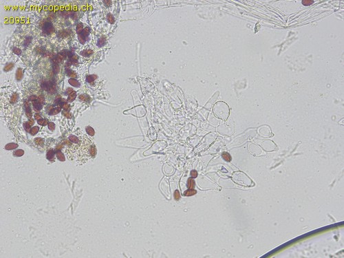 Psathyrella microrhiza - Kaulozystiden - 