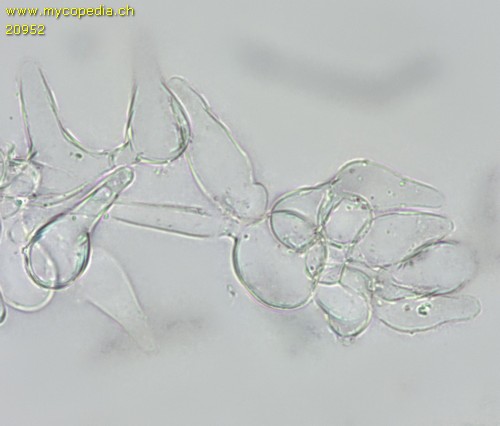 Psathyrella microrhiza - Kaulozystiden - 
