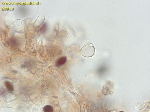 Psathyrella microrhiza - Parazystide - 