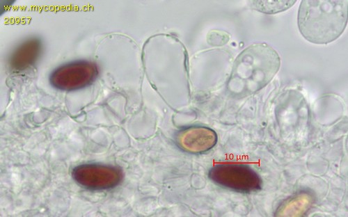 Psathyrella microrhiza - Pleurozystiden - Wasser  - 