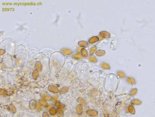 Conocybe moseri - Cheilozystiden - 