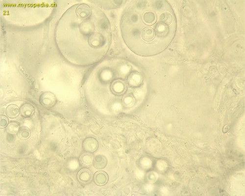 Terfezia claveryi - Ascus/Asci mit Sporen - 