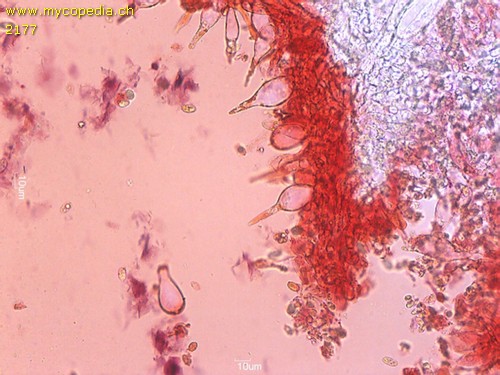 Mycena aetites - Cheilozystiden - Kongorot  - 