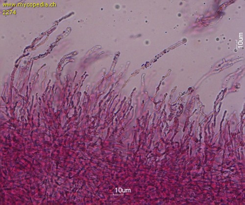 Russula emeticicolor - Primoridalhyphen inkrustiert - 