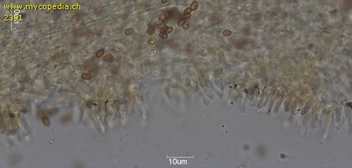 Pholiota cerifera - Cheilozystiden - 