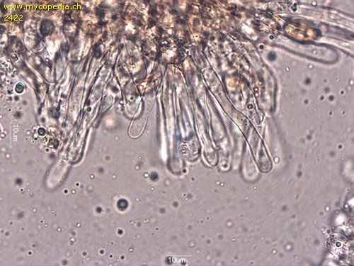 Phaeomarasmius rimulincola - Cheilozystiden - 