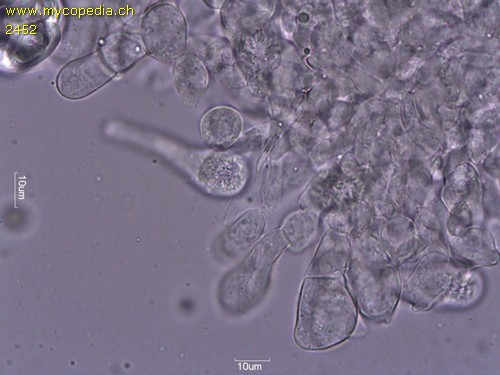 Macrolepiota procera - Cheilozystiden - 