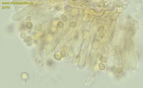 Clavulinopsis luteoalba - Sporen - Melzers  - 