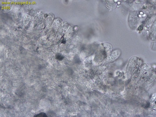 Lepiota micropholis - Cheilozystiden - 